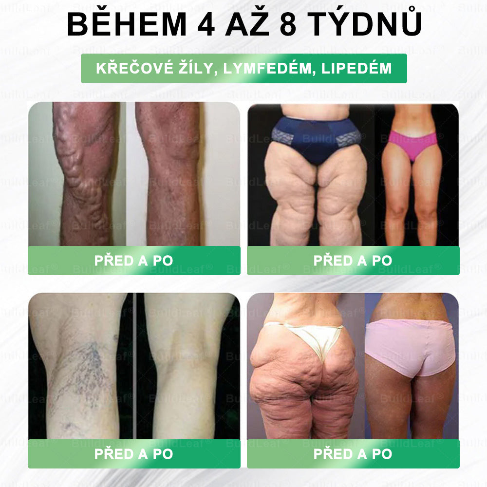 🏆Oficiální obchod | BuildLeaf® GLP-1 20-v-1 Slim & Zdraví orální roztok 💧 (1× denně, výsledky za 7 dní). Obsahuje 100 mld. CFU probiotik ✅ Podporuje hubnutí, zdraví srdce, trávení i energii.