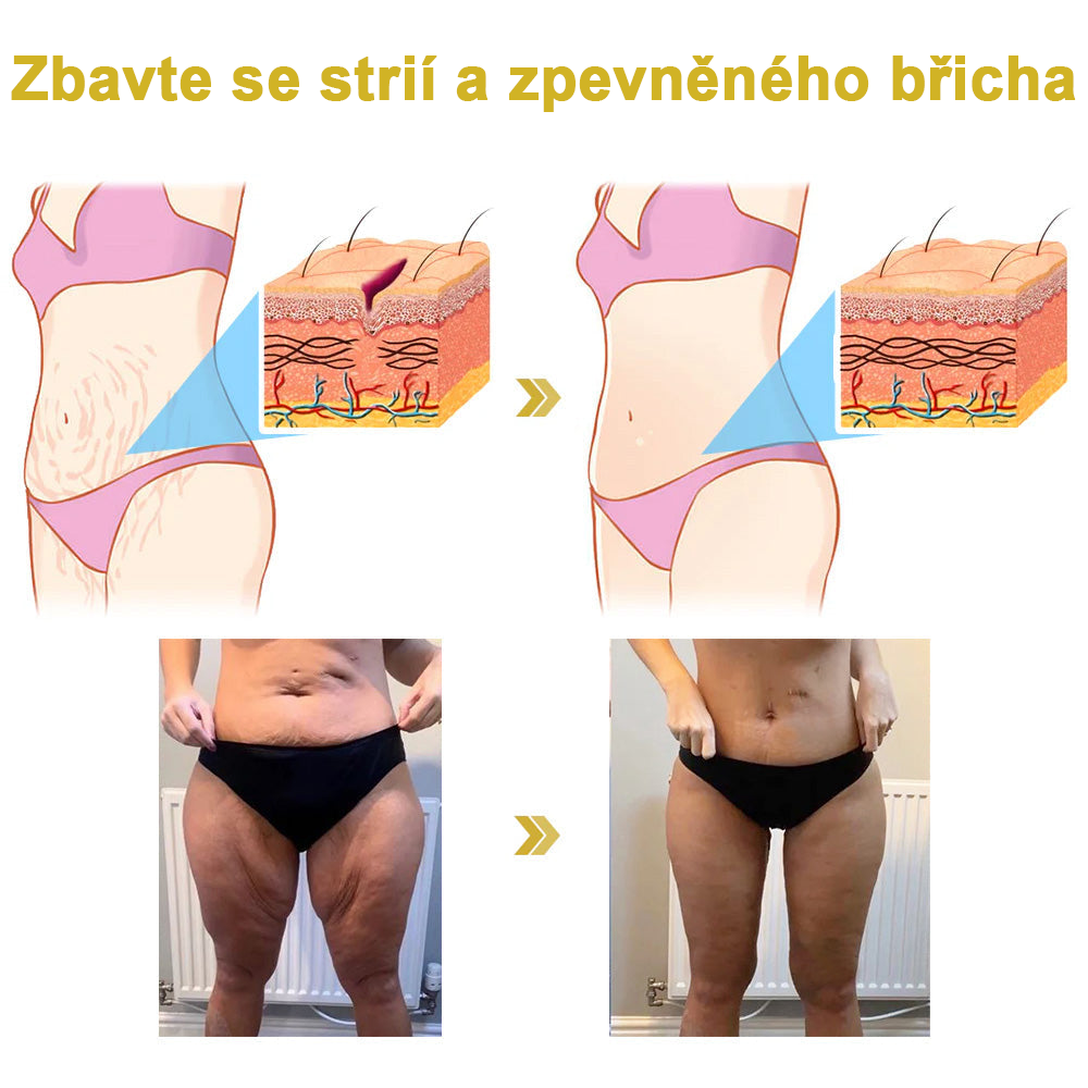 Vítěz ceny 2024 Readers' Choice 🏆 𝐌𝐨𝐨𝐧𝐝𝐚𝐫™ Zpevňující a regenerační krém: Obnovení elasticity pokožky