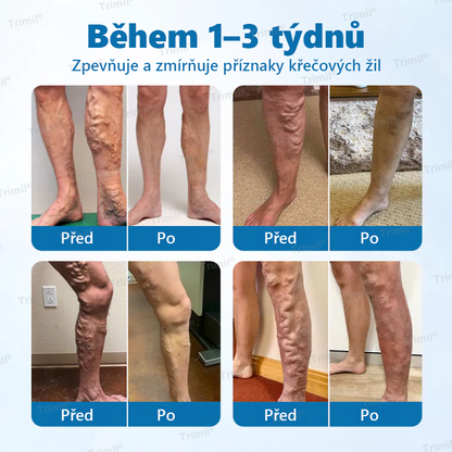 💙Trimil® VeinGuard Bylinný Sprej — ✅ Klinicky ověřeno, že dokáže zlepšit stav křečových žil už za pouhých 7 dní! 💙