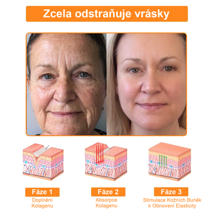Platba při převzetí 💰 PLTOWE® Krém s včelím jedem na bradavice a znaménka 🐝 (👨‍⚕Doporučeno dermatology AAD) 🔥 Poslední den akce – sleva 70%!🔥🔥