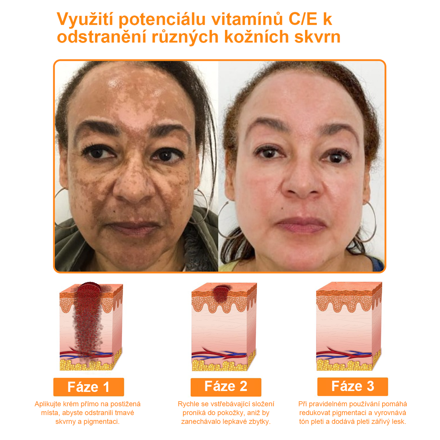 Platba při převzetí 💰 PLTOWE® Krém s včelím jedem na bradavice a znaménka 🐝 (👨‍⚕Doporučeno dermatology AAD) 🔥 Poslední den akce – sleva 70%!🔥🔥