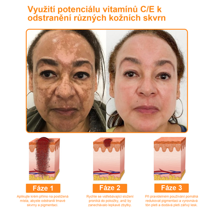 Platba při převzetí 💰 PLTOWE® Krém s včelím jedem na bradavice a znaménka 🐝 (👨‍⚕Doporučeno dermatology AAD) 🔥 Poslední den akce – sleva 70%!🔥🔥