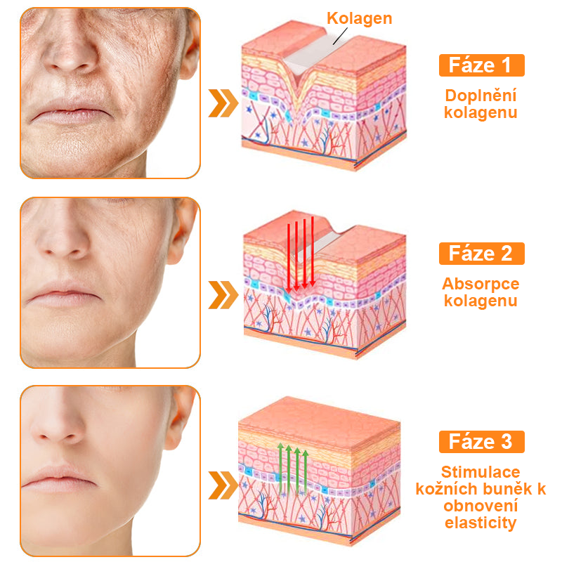 Platba při převzetí 💰 PLTOWE® Krém s včelím jedem na bradavice a znaménka 🐝 (👨‍⚕Doporučeno dermatology AAD) 🔥 Poslední den akce – sleva 70%!🔥🔥