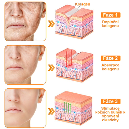 Platba při převzetí 💰 PLTOWE® Krém s včelím jedem na bradavice a znaménka 🐝 (👨‍⚕Doporučeno dermatology AAD) 🔥 Poslední den akce – sleva 70%!🔥🔥