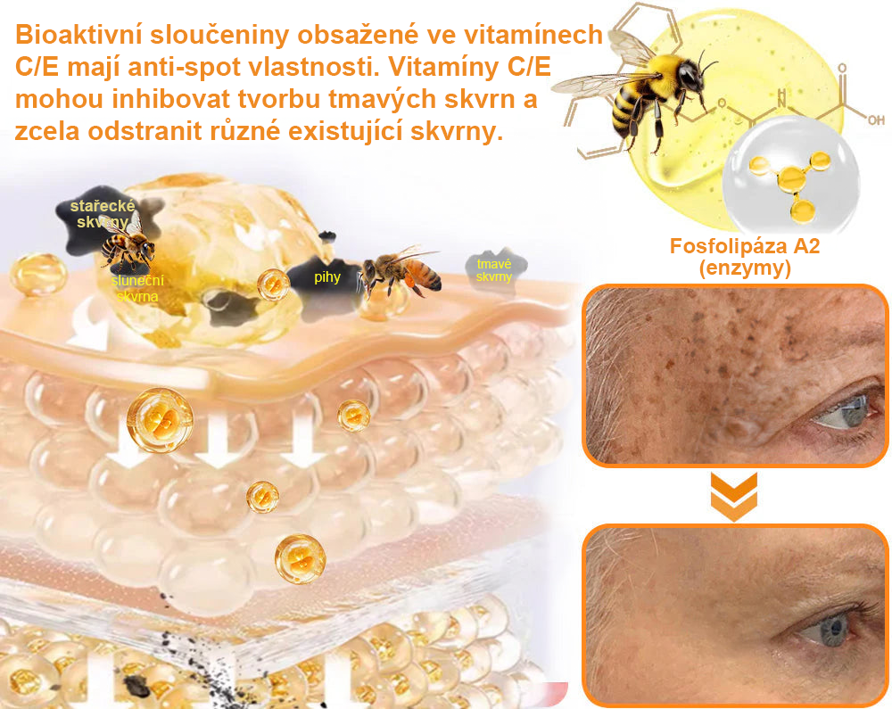 Platba při převzetí 💰 PLTOWE® Krém s včelím jedem na bradavice a znaménka 🐝 (👨‍⚕Doporučeno dermatology AAD) 🔥 Poslední den akce – sleva 70%!🔥🔥