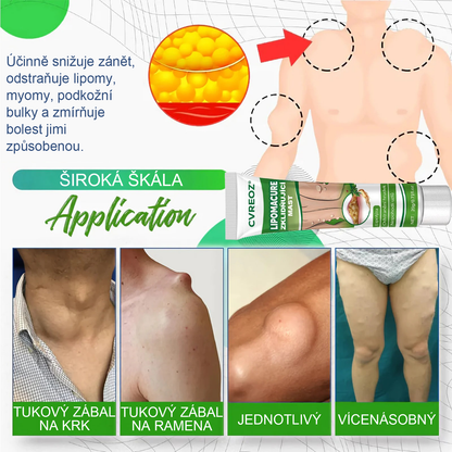 Cvreoz® LipomaCure — Účinná péče o lipomy bez operace