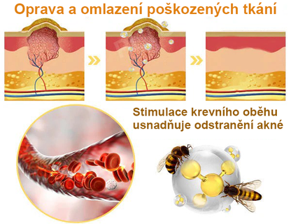 Platba při převzetí 💰 PLTOWE® Krém s včelím jedem na bradavice a znaménka 🐝 (👨‍⚕Doporučeno dermatology AAD) 🔥 Poslední den akce – sleva 70%!