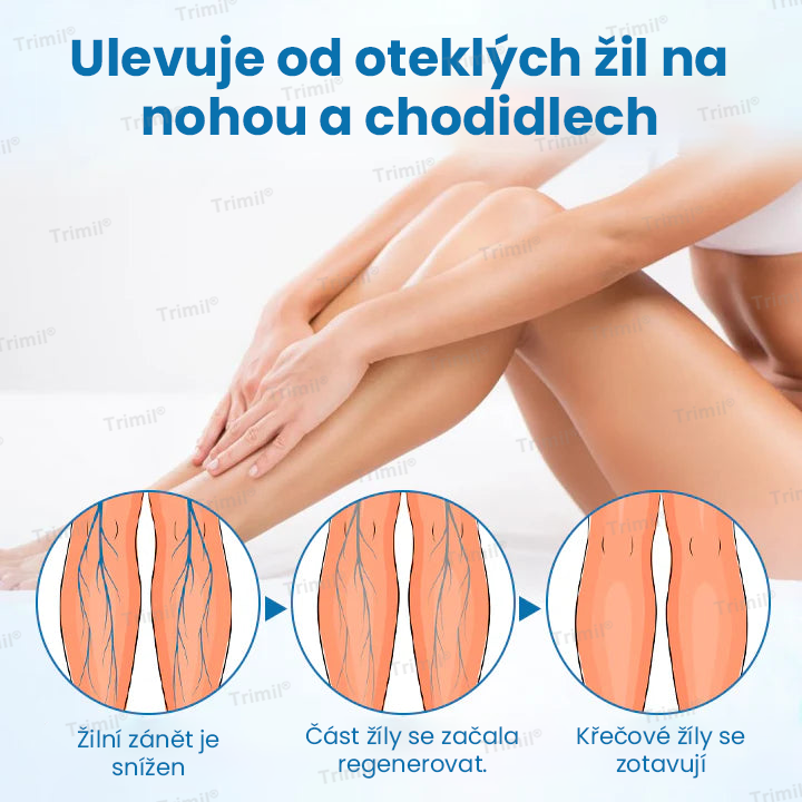 💙Trimil® VeinGuard Bylinný Sprej — ✅ Klinicky ověřeno, že dokáže zlepšit stav křečových žil už za pouhých 7 dní! 💙