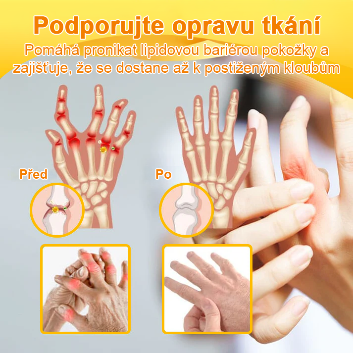✅Oficiální obchod: Ourlyard™ Hořčíkový olej a medový sprej na opravu kloubů👨‍⚕️Schváleno Evropskou agenturou pro léčivé přípravky a zdravotnické prostředky (EMA)🔥