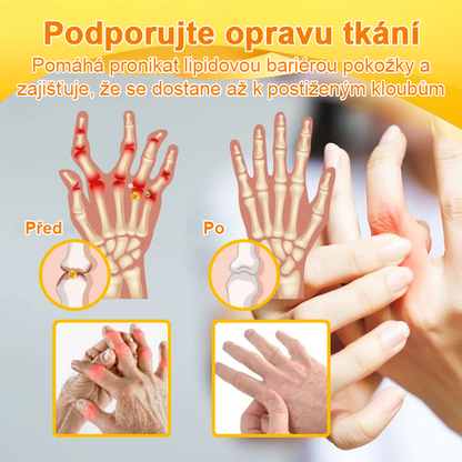 ✅Oficiální obchod: Ourlyard™ Hořčíkový olej a medový sprej na opravu kloubů👨‍⚕️Schváleno Evropskou agenturou pro léčivé přípravky a zdravotnické prostředky (EMA)🔥