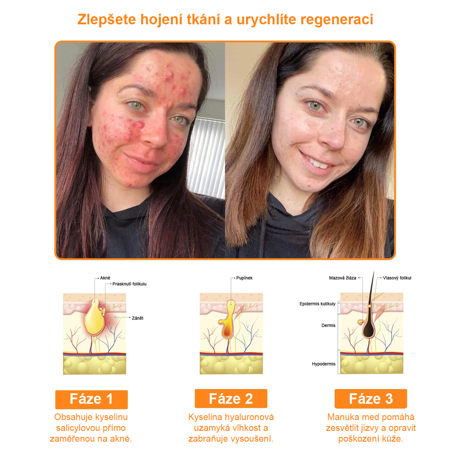 Platba při převzetí 💰 PLTOWE® Krém s včelím jedem na bradavice a znaménka 🐝 (👨‍⚕Doporučeno dermatology AAD) 🔥 Poslední den akce – sleva 70%!🔥🔥